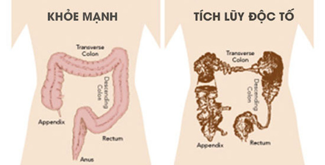 Những loại nước nên uống để thải độc giúp cơ thể luôn khoẻ mạnh