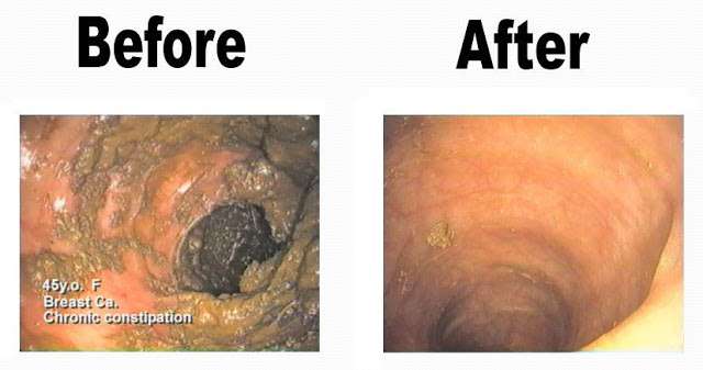 Vì sao cần phải lọc nước?